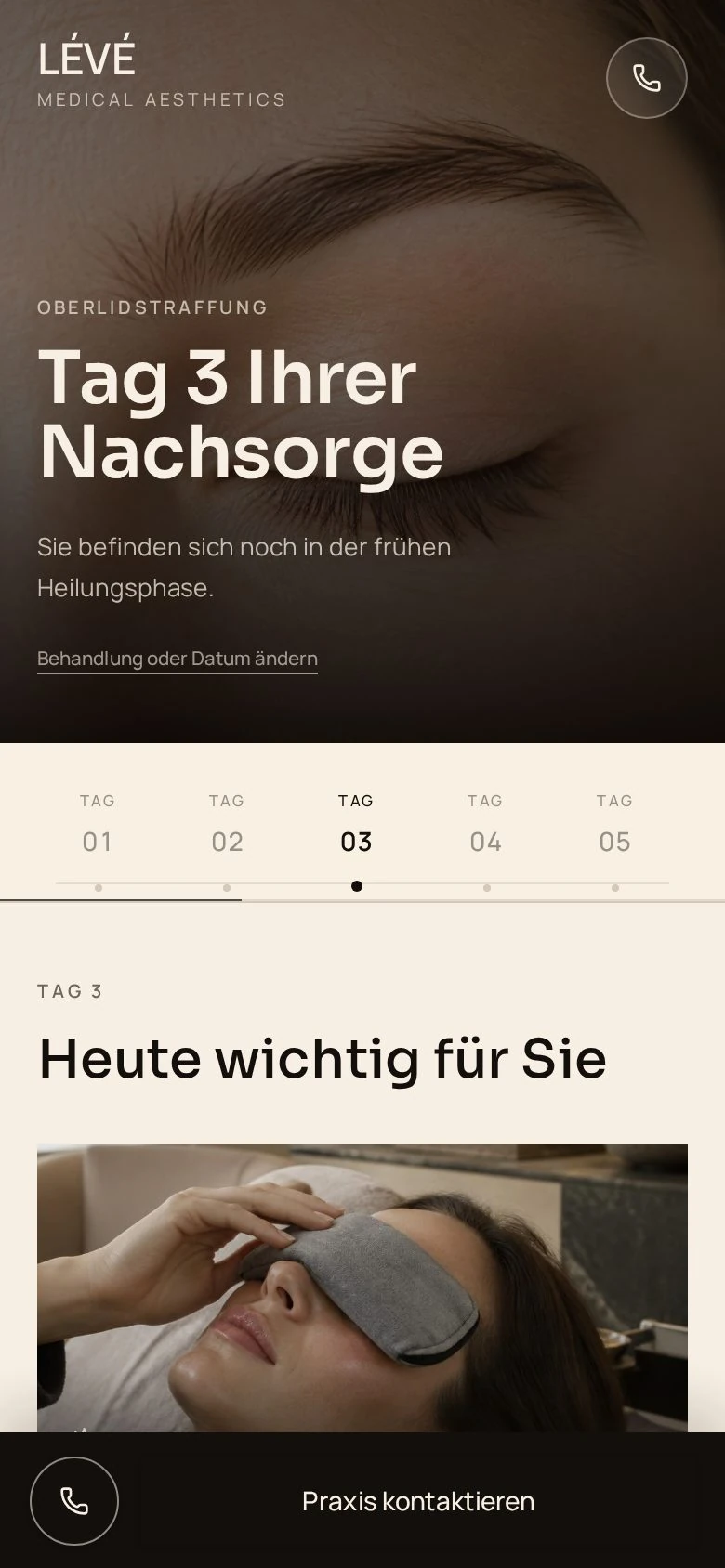 Echte AfterCare-Ansicht: Tag 3 nach einer Oberlidstraffung bei LÉVÉ